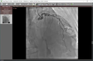 心脏造影视频播放器 | RadiAnt DICOM Viewer / Dicom Viewer（v2025.1 / v3.0.28.1210）-软件工具箱